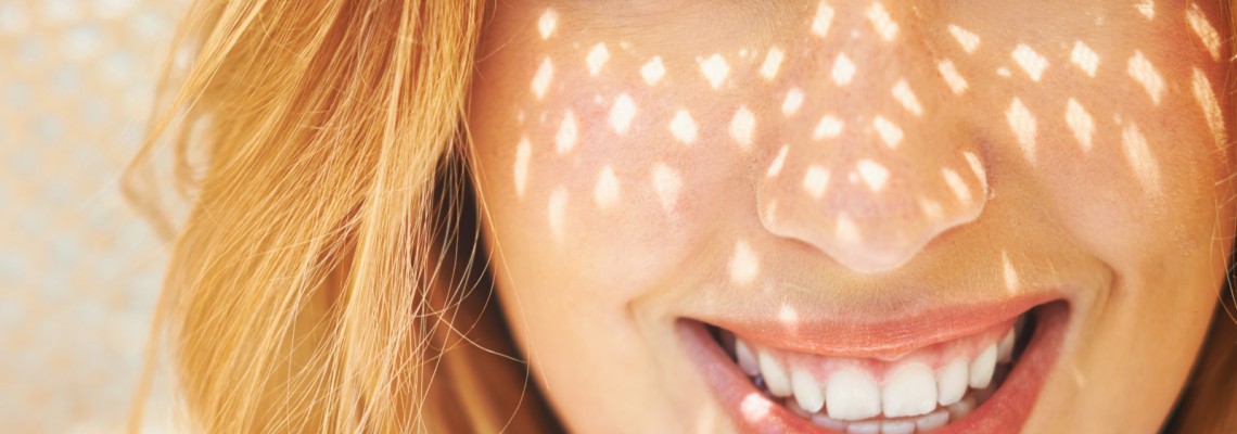 Kozmetik Lenslerde UV Koruma ve Göz Sağlığı